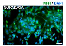 Biology: Amniotic fluid may yield new, better treatment for ischemic stroke