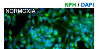 Biology: Amniotic fluid may yield new, better treatment for ischemic stroke