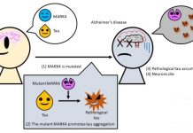 Biology: Cause of Alzheimer’s disease traced to mutation in common enzyme