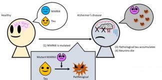 Biology: Cause of Alzheimer’s disease traced to mutation in common enzyme