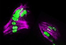 Biology: Chromosome defects seen from over-exchange of DNA in sperm and eggs