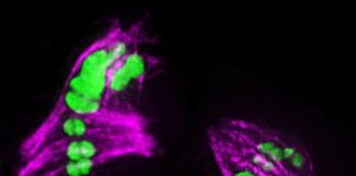 Biology: Chromosome defects seen from over-exchange of DNA in sperm and eggs