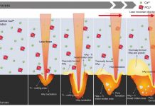 Biology: Coating implants with ‘artificial bone’ to prevent inflammation