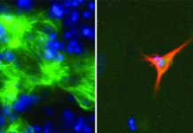 Biology: Computational approach to optimise culture conditions required for cell therapy