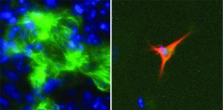 Biology: Computational approach to optimise culture conditions required for cell therapy