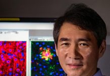 Biology: Enzyme SSH1 impairs disposal of accumulating cellular garbage, leading to brain cell death