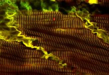 Biology: New study provides fresh hope for children suffering from rare muscle diseases