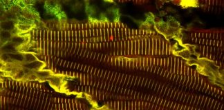 Biology: New study provides fresh hope for children suffering from rare muscle diseases