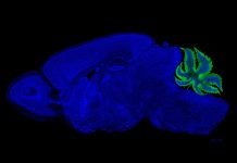 Biology: Rethinking the link between cannabinoids and learning