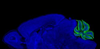 Biology: Rethinking the link between cannabinoids and learning
