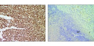 Biology: The CNIO reprograms CRISPR system in mice to eliminate tumor cells without affecting healthy cells
