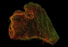 Biology: The choroid plexus: A conduit for prenatal inflammation?