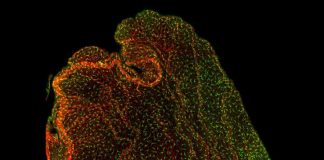 Biology: The choroid plexus: A conduit for prenatal inflammation?