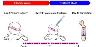 Coupling antibiotics with stem cells to fight off bone infections (TDnews)