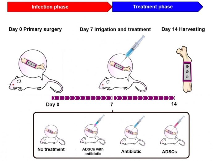 Coupling antibiotics with stem cells to fight off bone infections