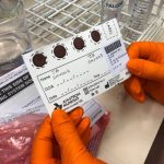 Dried blood spot sampling offers inexpensive way to widen access to antibody testing for COVID-19 (TDnews)