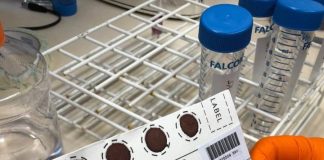 Dried blood spot sampling offers inexpensive way to widen access to antibody testing for COVID-19 (TDnews)