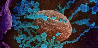 Every COVID-19 case seems different; these scientists want to know why (TDnews)