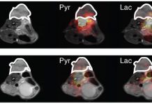 Imaging technique could replace tissue biopsies in assessing drug resistance in cancer (TDnews)