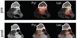 Imaging technique could replace tissue biopsies in assessing drug resistance in cancer (TDnews)