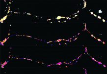 NIH scientists reveal how the brain may fuel intense neural communication (TDnews)