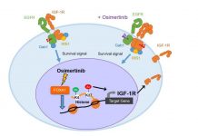 Potential drug treatment for particular type of lung-cancer (TDnews)