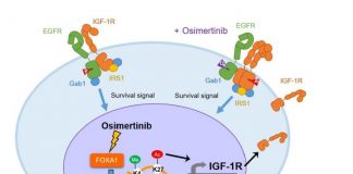 Potential drug treatment for particular type of lung-cancer (TDnews)