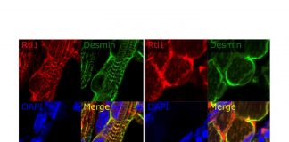 RTL1 gene a likely culprit behind temple and Kagami-Ogata syndromes (TDnews)