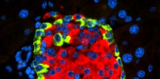 Research: A CNIO team describes how a virus can cause diabetes