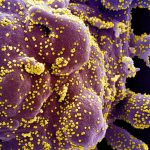 Research: Blocking immune system pathway may stop Coronavirus infection, prevent severe organ damage