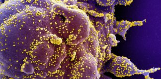 Research: Blocking immune system pathway may stop Coronavirus infection, prevent severe organ damage