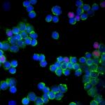 Research: Severe Coronavirus infection linked to overactive immune cells