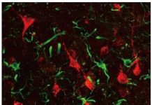 Biology: First non-human primate research showing promise of gene therapy for stroke repair