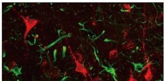 Biology: First non-human primate research showing promise of gene therapy for stroke repair