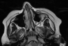 Biology: Personalized drug screens could guide treatment for children with brain cancer