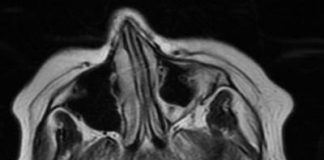 Biology: Personalized drug screens could guide treatment for children with brain cancer