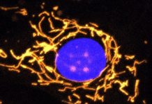 Biology: Researchers develop new gene therapy for eye disease