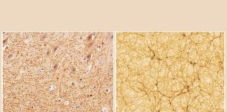 Space: Does the human brain resemble the Universe?