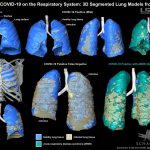 Research: LSU health team wins Best 2020 Radiology Image award