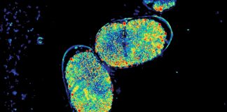 Biology: CZI awards nearly $32 million to advance biomedical imaging