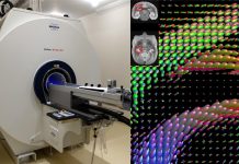 Biology: Machine intelligence accelerates study into mapping brains