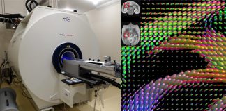 Biology: Machine intelligence accelerates study into mapping brains