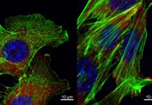 Biology: Regulatory RNAs promote breast cancer metastasis