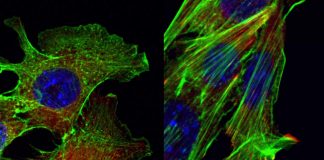 Biology: Regulatory RNAs promote breast cancer metastasis