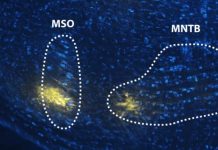 Biology: Research sheds new light on how the brain distinguishes speech from noise