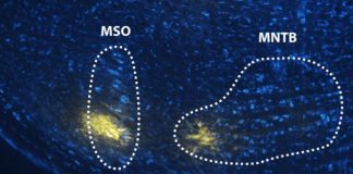 Biology: Research sheds new light on how the brain distinguishes speech from noise