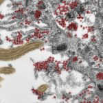 Research: How SARS-CoV-2 reaches the brain