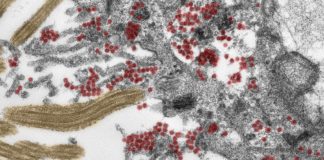 Research: How SARS-CoV-2 reaches the brain