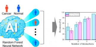 Biology: Cancer can be precisely diagnosed using a urine test with artificial intelligence