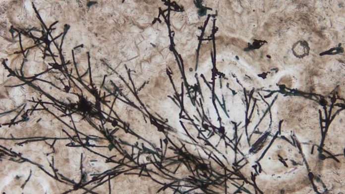 635 million-year-old fossil is the oldest known land fungus (Study)